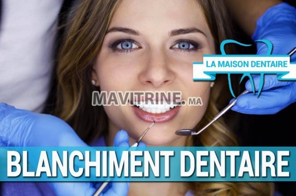 SNAP ON SMILE ET APPAREIL VALPLAST ET LE BLANCHIMENT DENTAIRE